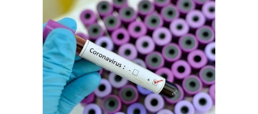 BPPT: AI Miliki Peran Penting Terkait Wabah Virus Corona BPPT: AI Miliki Peran Penting Terkait Wabah Virus Corona